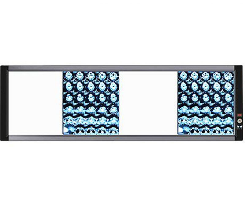 X射線(xiàn)膠片觀片燈